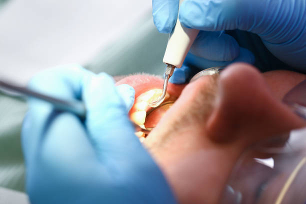 Best Emergency Broken Tooth Repair in Mayer, MN
